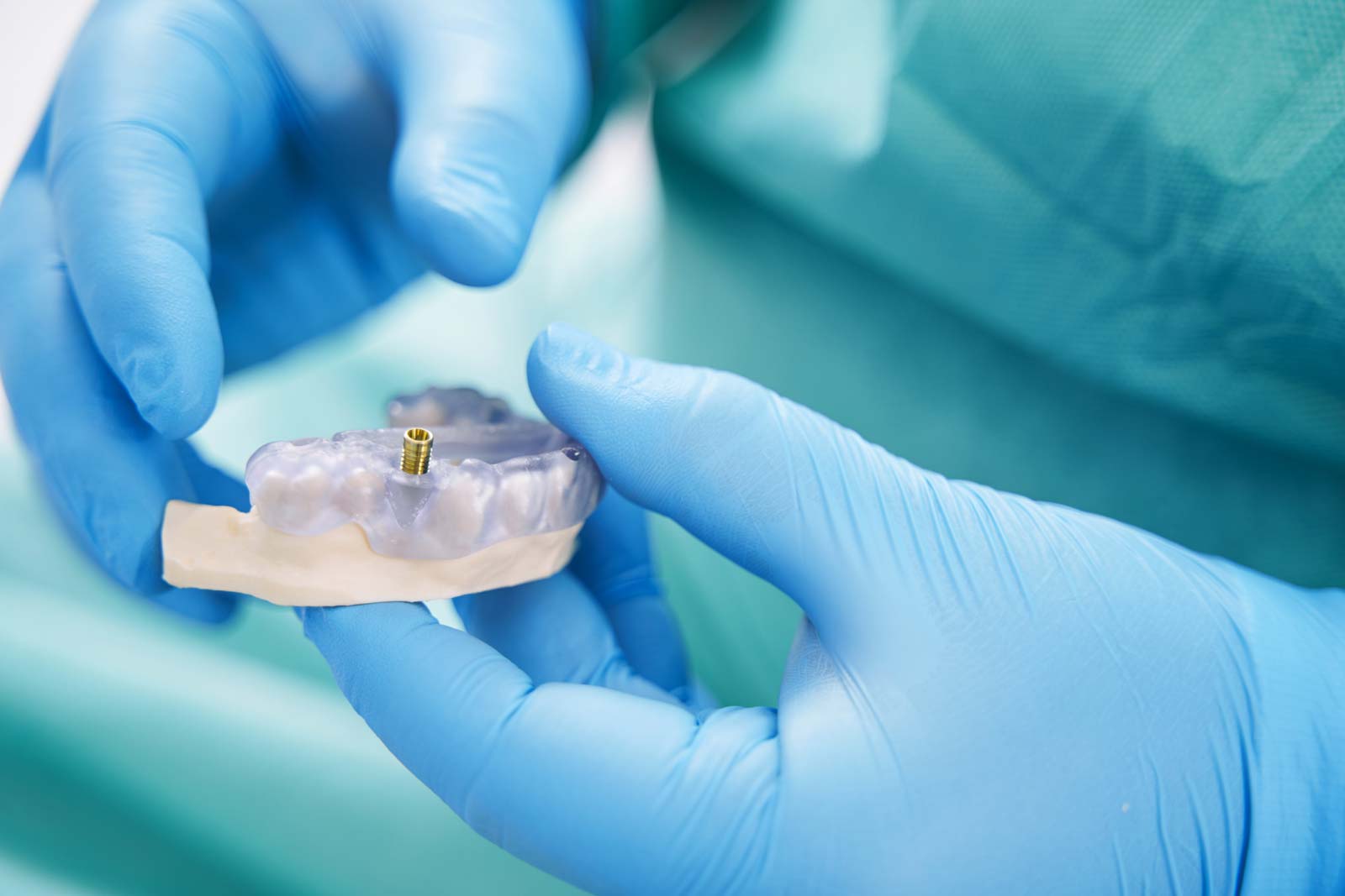 implantologia dentista amoretti